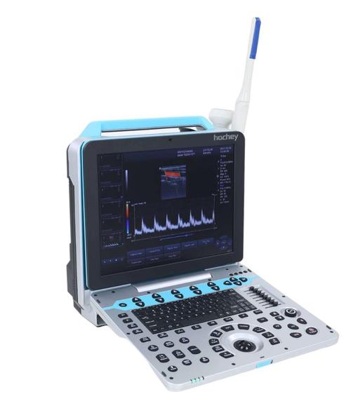 doppler ultrasound machine