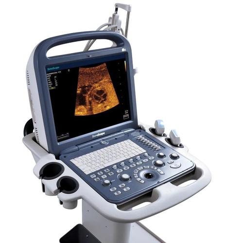 doppler ultrasound machine