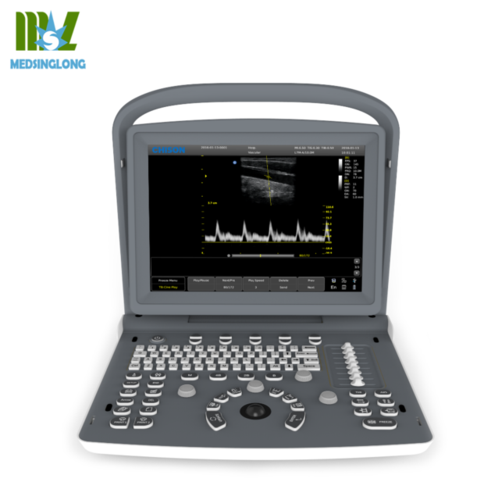 affordable ultrasound machine