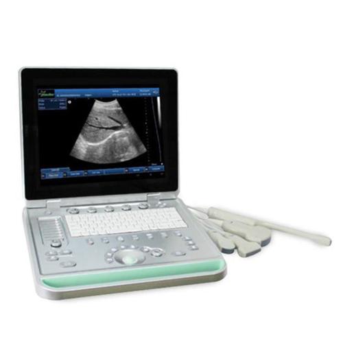 Advanced Portable Ultrasound Machine for Sale with Color Doppler Imaging