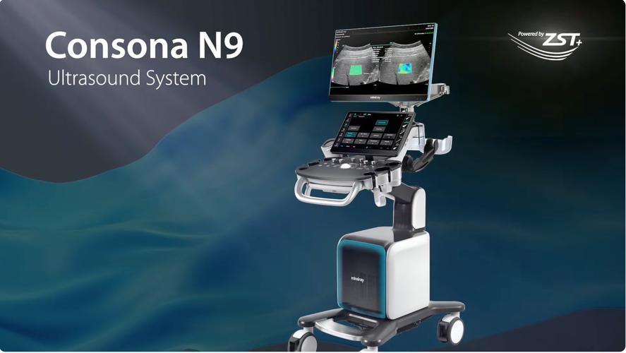 ultrasound machine for sale
