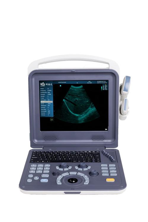 ultrasound scanner