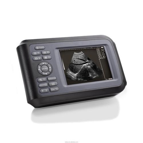 compact ultrasound machine