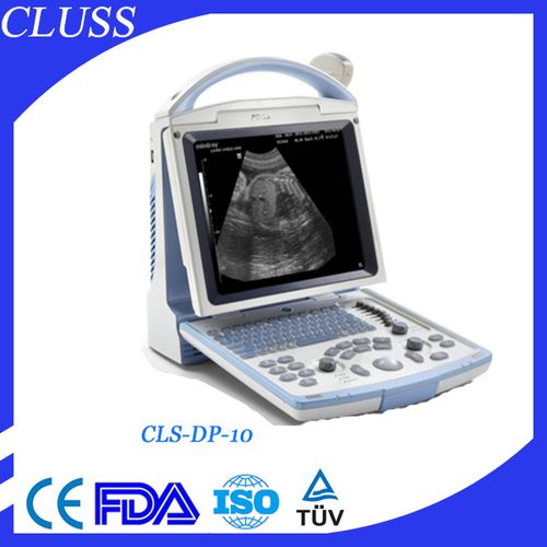 compact ultrasound machine