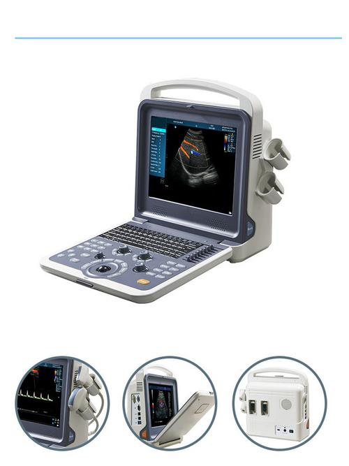 digital ultrasound machine