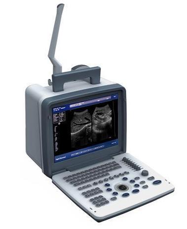 digital ultrasound machine