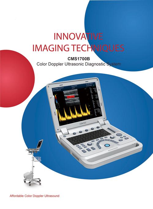 ultrasound equipment