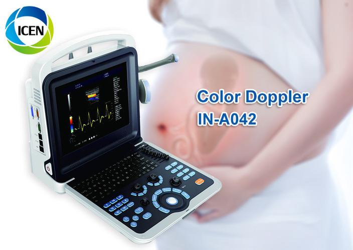 3D ultrasound machine in obstetric examination