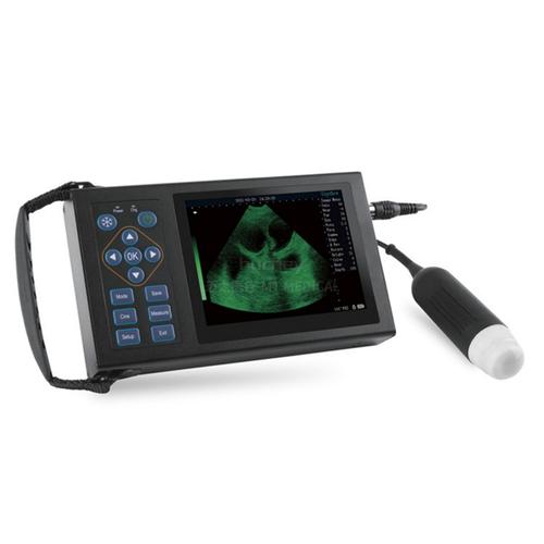 handheld ultrasound machine