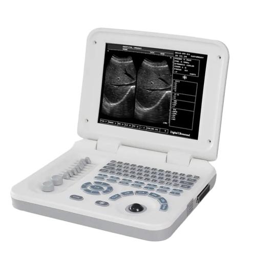 handheld ultrasound machine