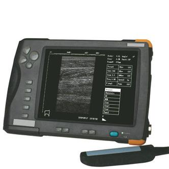 handheld ultrasound machine