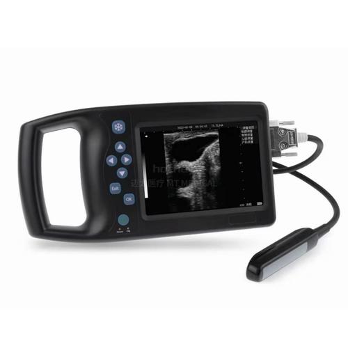 handheld ultrasound machine