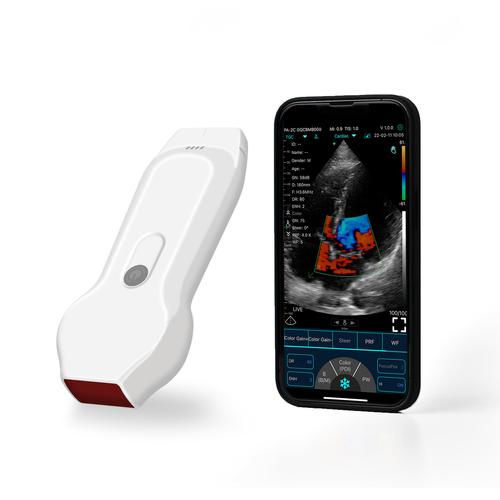 ultrasound imaging machine