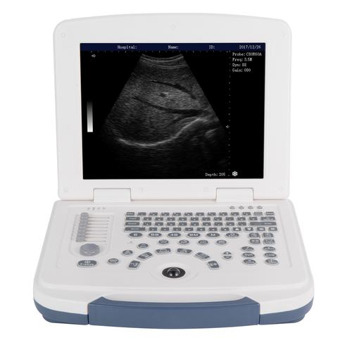 ultrasound machine manufacturers