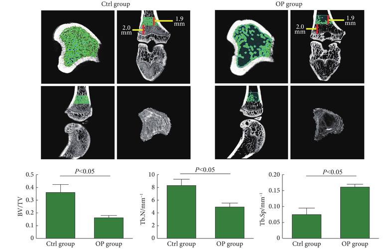 microcurrent muscle stimulator