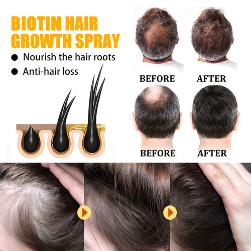 hair growth devices before and after