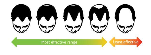 hair growth laser devices