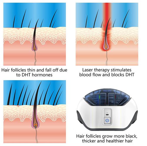 hair growth devices for alopecia