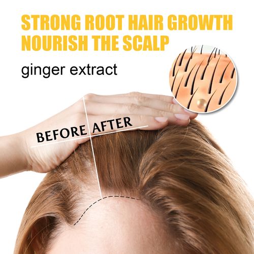 best hair growth devices