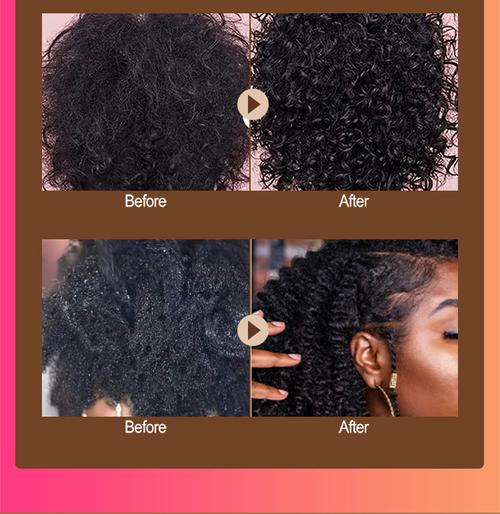 hair growth devices for baldness