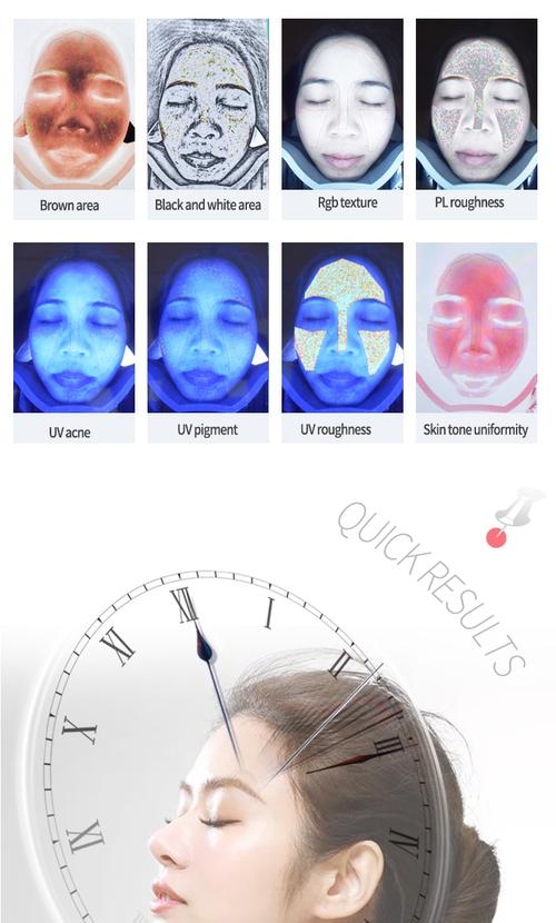 skin health analysis machine