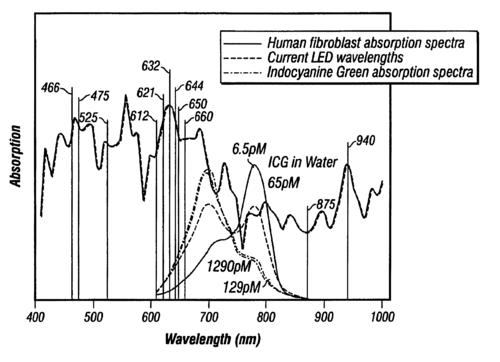 Body light therapy device assembly line with quality control checkpoints