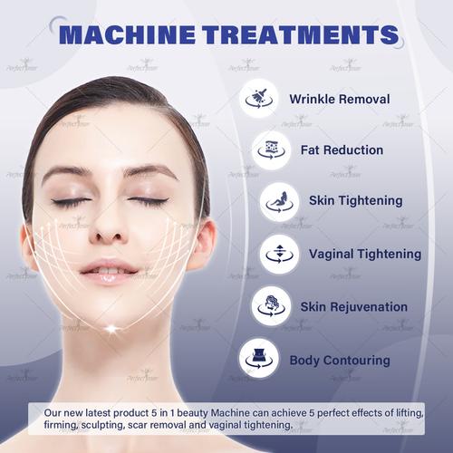 HIFU wrinkle treatment