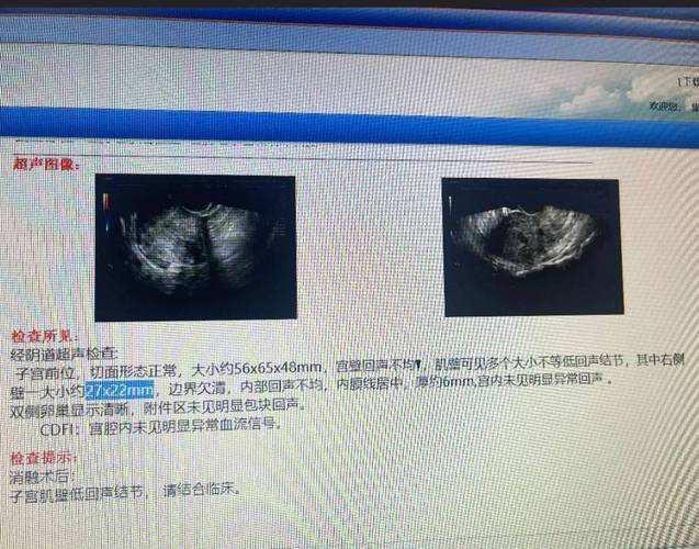 HIFU machine assembly line with quality checkpoints