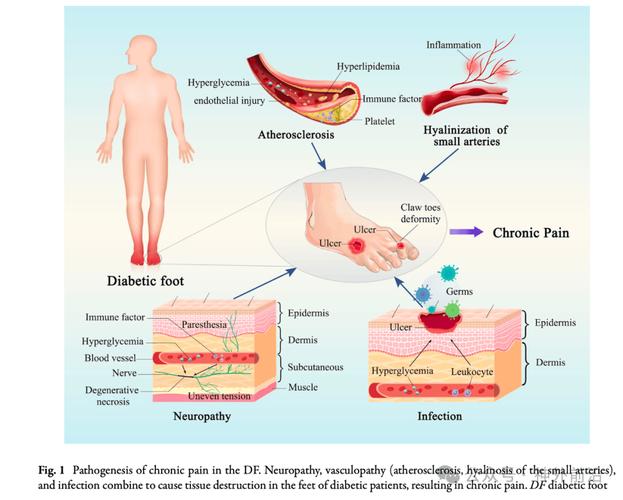 light therapy for hands and feet pain