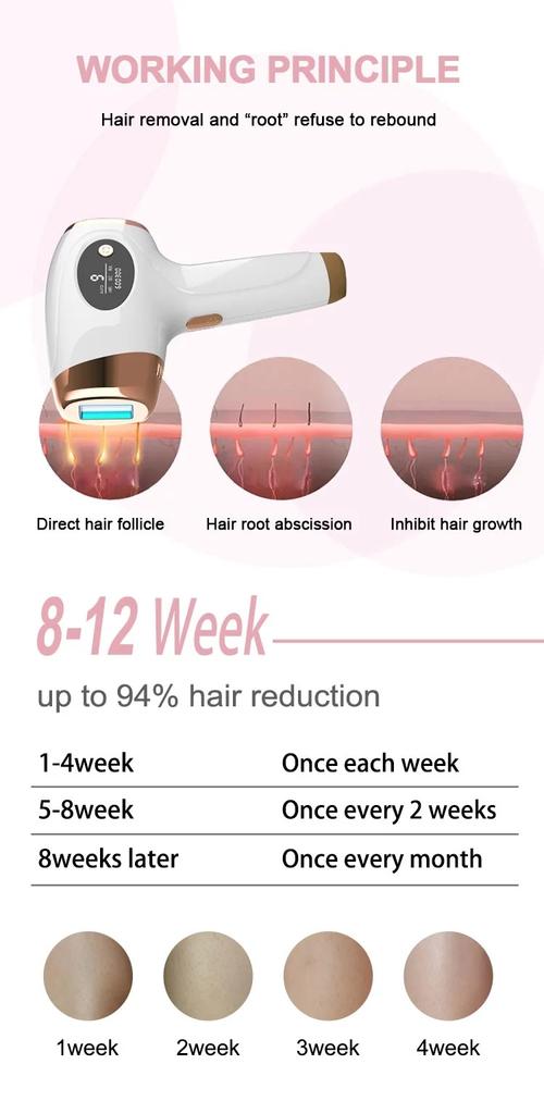 IPL laser hair removal