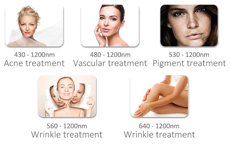 IPL hair removal before and after