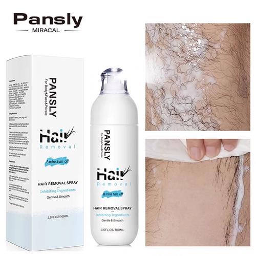 IPL hair removal handset