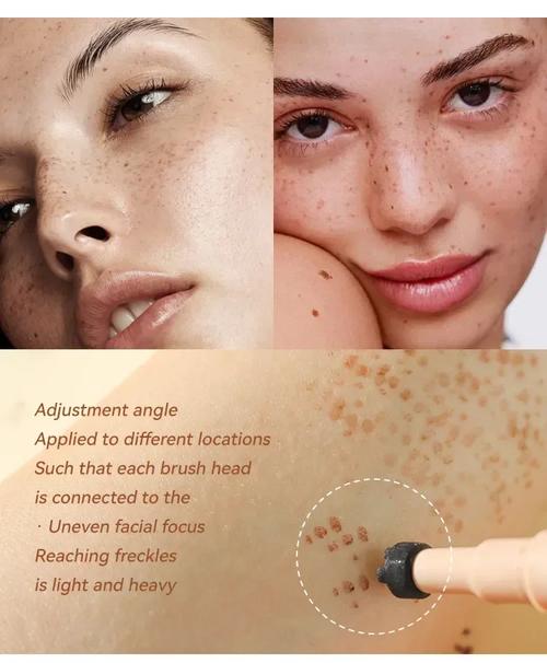 microneedling pen for face