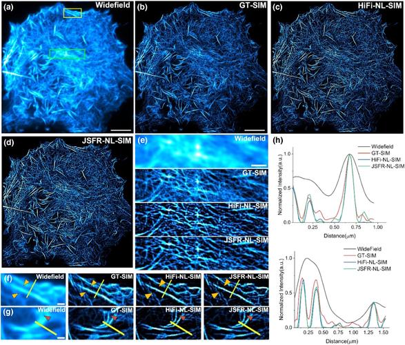 RF microneedling cartridges