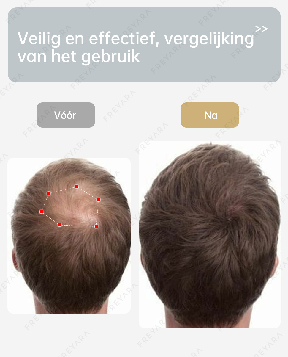 Second slide