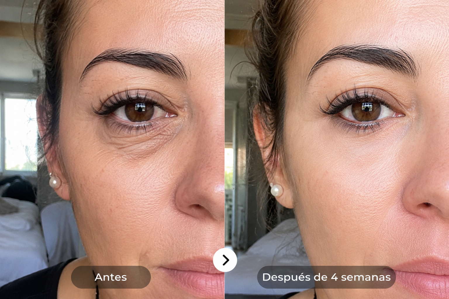 Comparación área de ojos