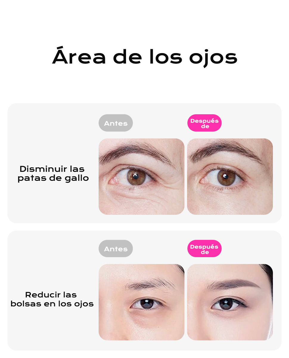 Segunda diapositiva