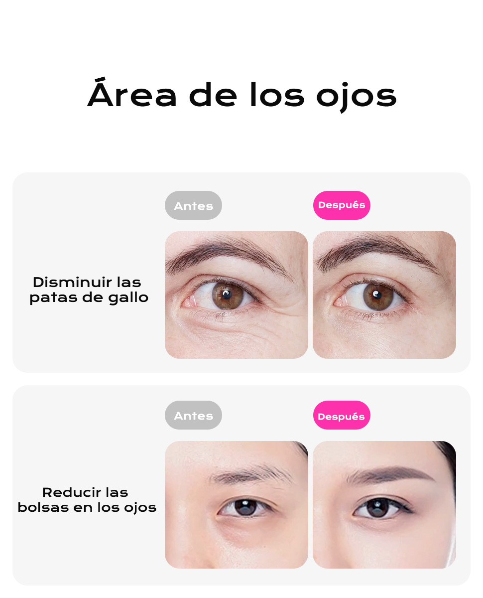 Segunda diapositiva